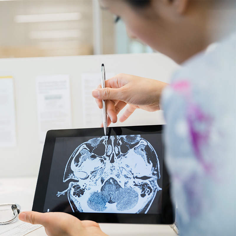 Neuro doctors reviewing brain scans